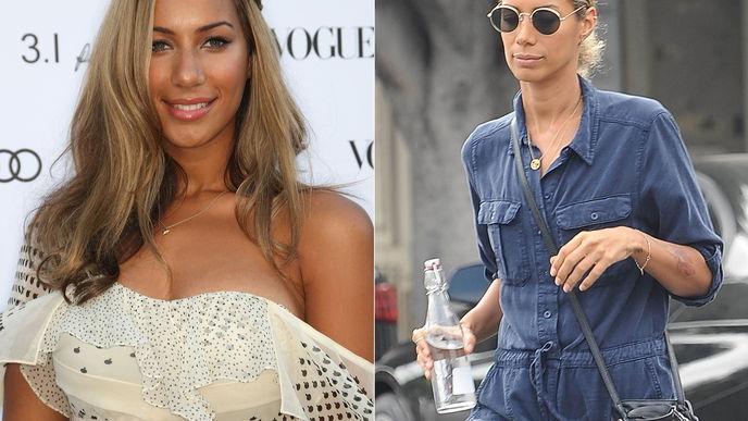 Leona Lewis: erstaunliche Veränderung
