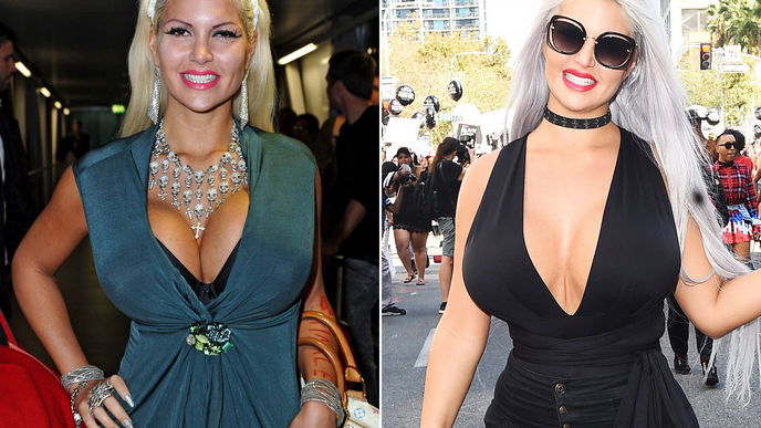 Sophia "Vegas“ Wollersheim und ihre krassen OPs