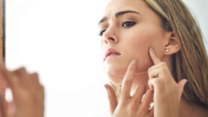 Unreine Haut? Dann befolge diese Tipps!