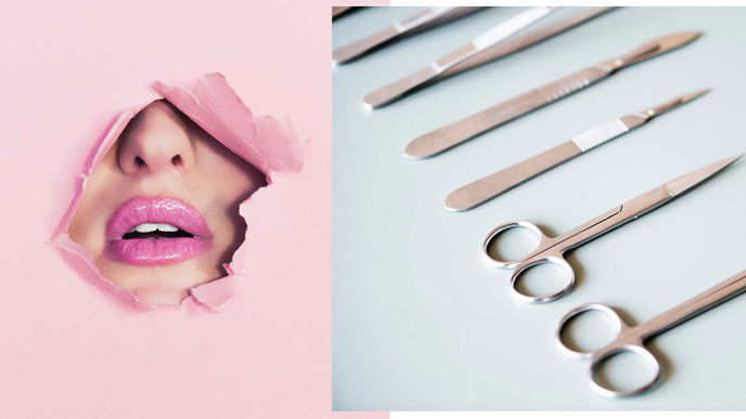 Gefährlicher Beauty-Trend: Immer mehr Schönheits-OPs basieren auf Snapchat-Filtern