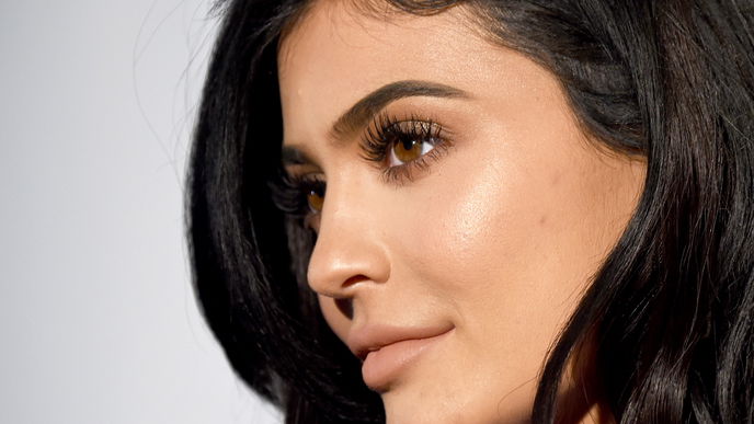Lip Filler: Was ist das eigentlich?